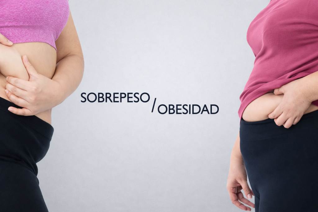 Obesidad / Sobrepeso